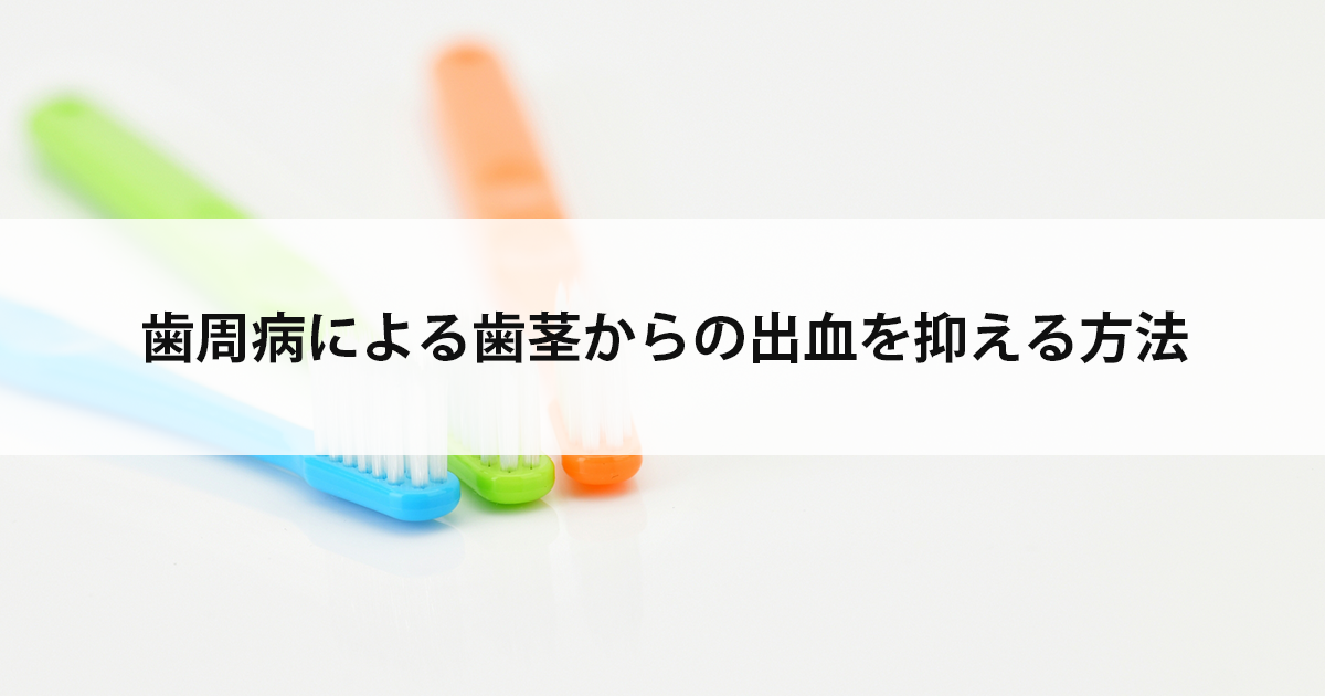 【新潟市中央区新潟駅の歯医者】歯周病による歯茎からの出血を抑える方法