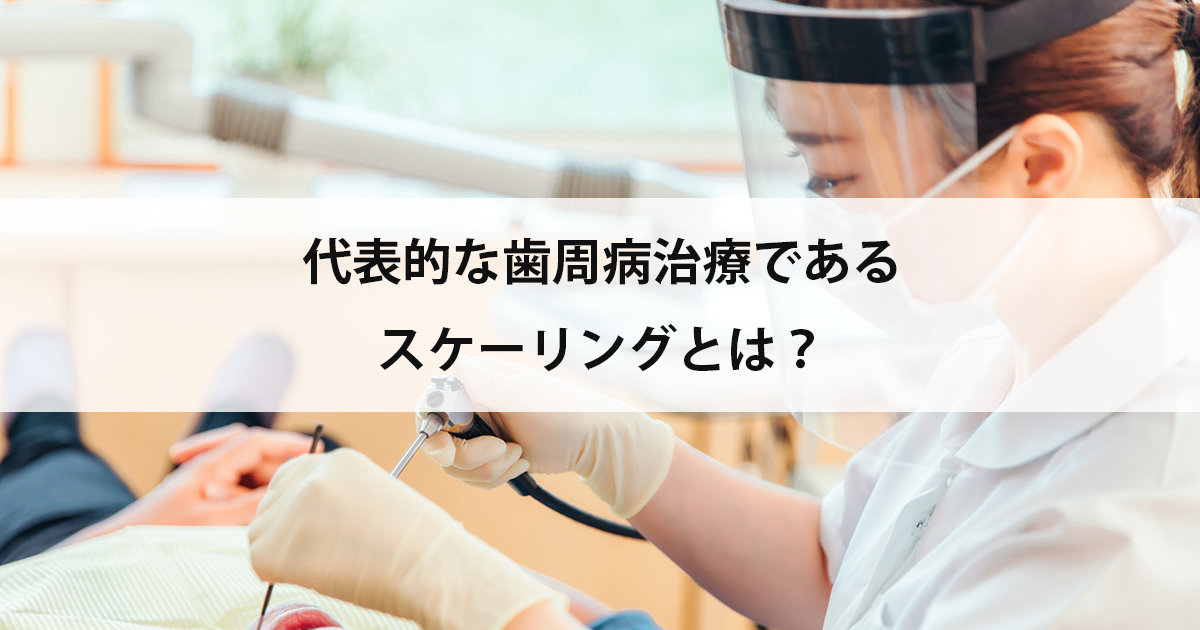 【新潟市中央区新潟駅の歯医者】代表的な歯周病治療であるスケーリングとは?