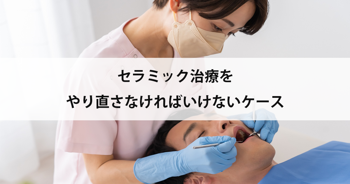 【新潟市中央区新潟駅の歯医者】セラミック治療をやり直さなければいけないケース