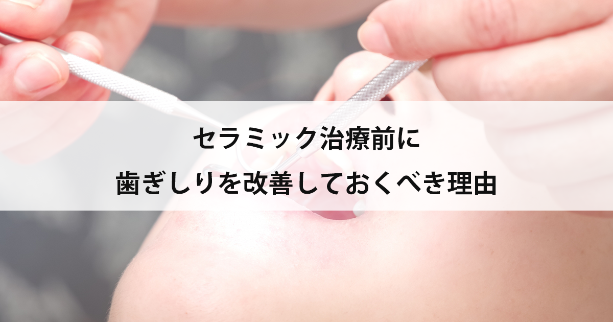 【新潟市中央区新潟駅の歯医者】セラミック治療前に歯ぎしりを改善しておくべき理由