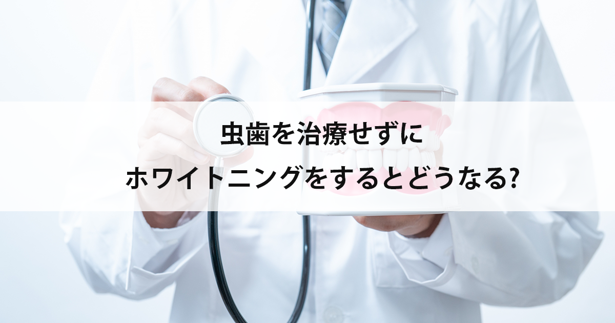 【新潟市中央区新潟駅の歯医者でホワイトニング】虫歯を治療せずにホワイトニングをするとどうなる?