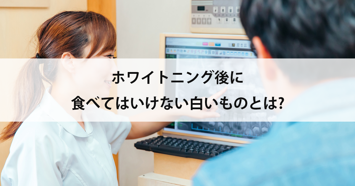 【新潟市中央区新潟駅の歯医者でホワイトニング】ホワイトニング後に食べてはいけない白いものとは?