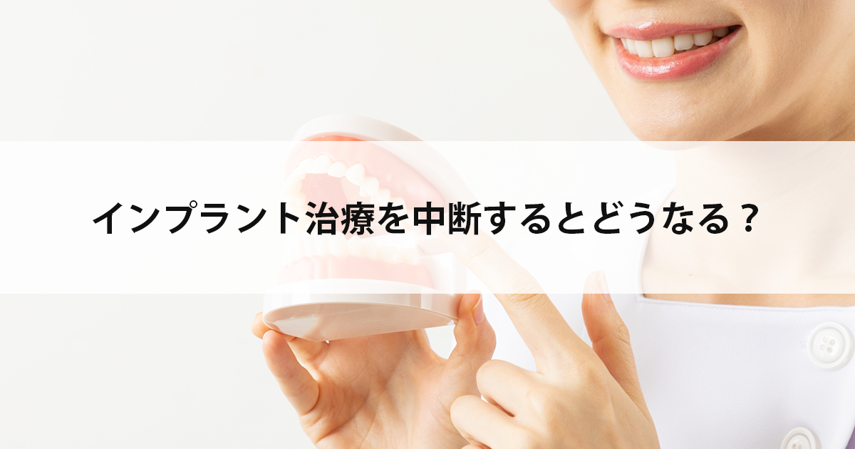 【新潟市中央区新潟駅の歯医者でインプラント】インプラント治療を中断するとどうなる?