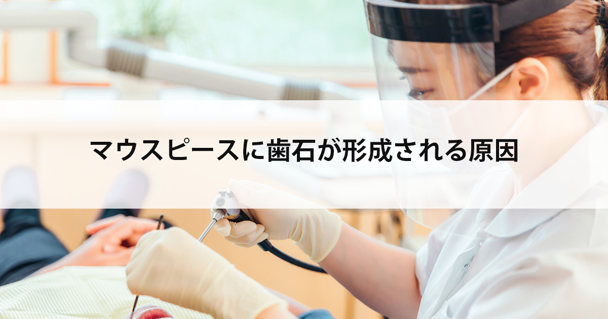 【新潟市中央区新潟駅の歯医者でマウスピース】マウスピースに歯石が形成される原因