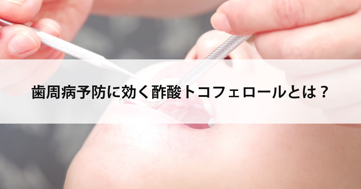 【新潟市中央区新潟駅の歯医者で歯周病治療】歯周病予防に効く酢酸トコフェロールとは?